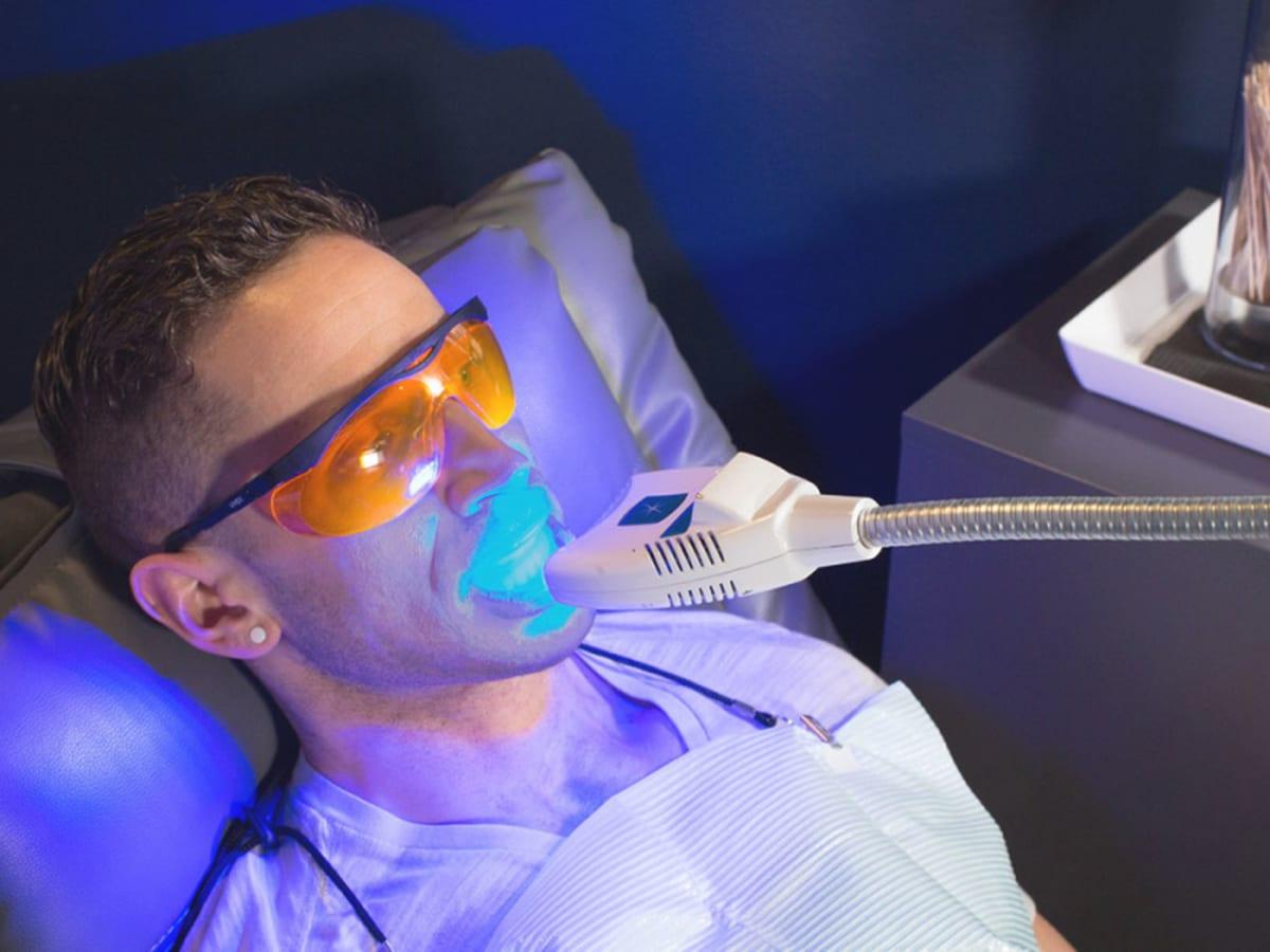 8 best teeth whitening clinics in sydney for a sparkling smile