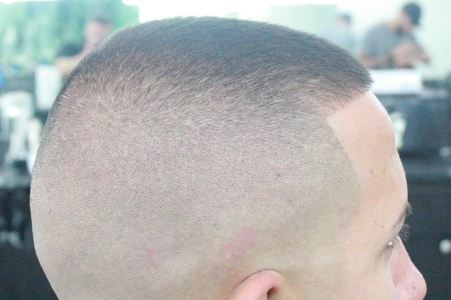 buzz cut receding hairline