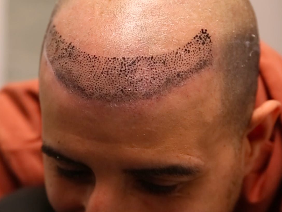 A Guide to Hairline Tattoos