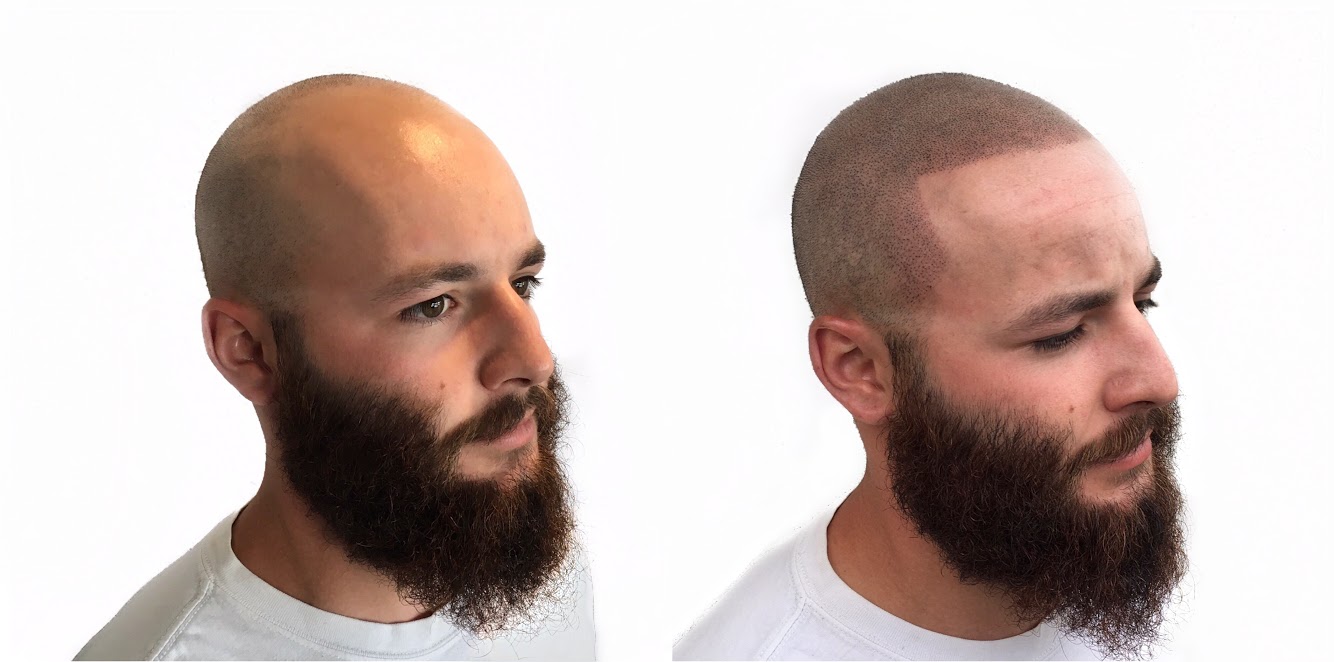 Men with tattoos bald Should Bald