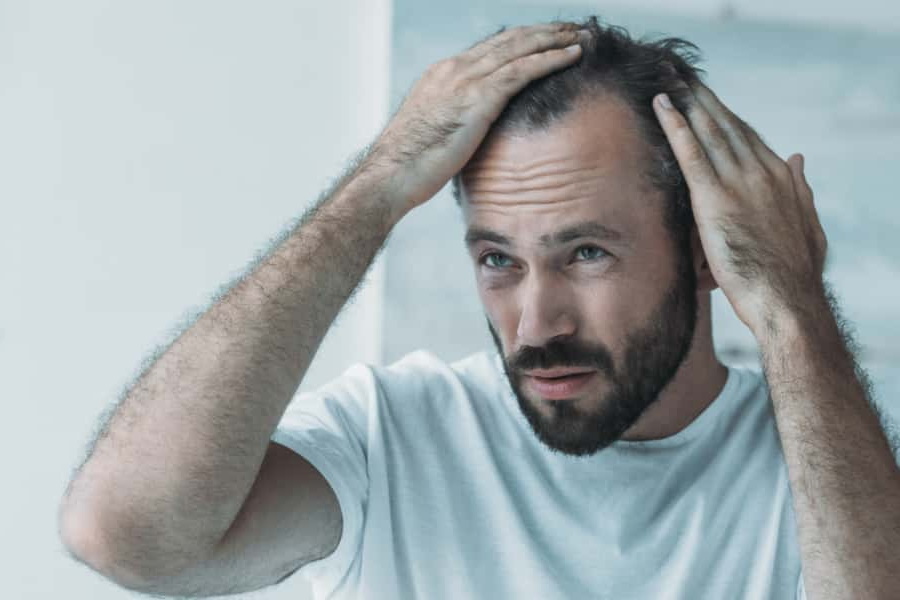 6-common-hair-loss-causes-in-men-man-of-many