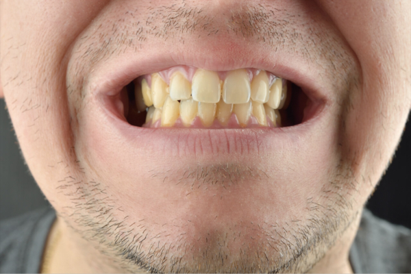 4 Ways to Whiten Your Teeth Naturally at Home | Man of Many