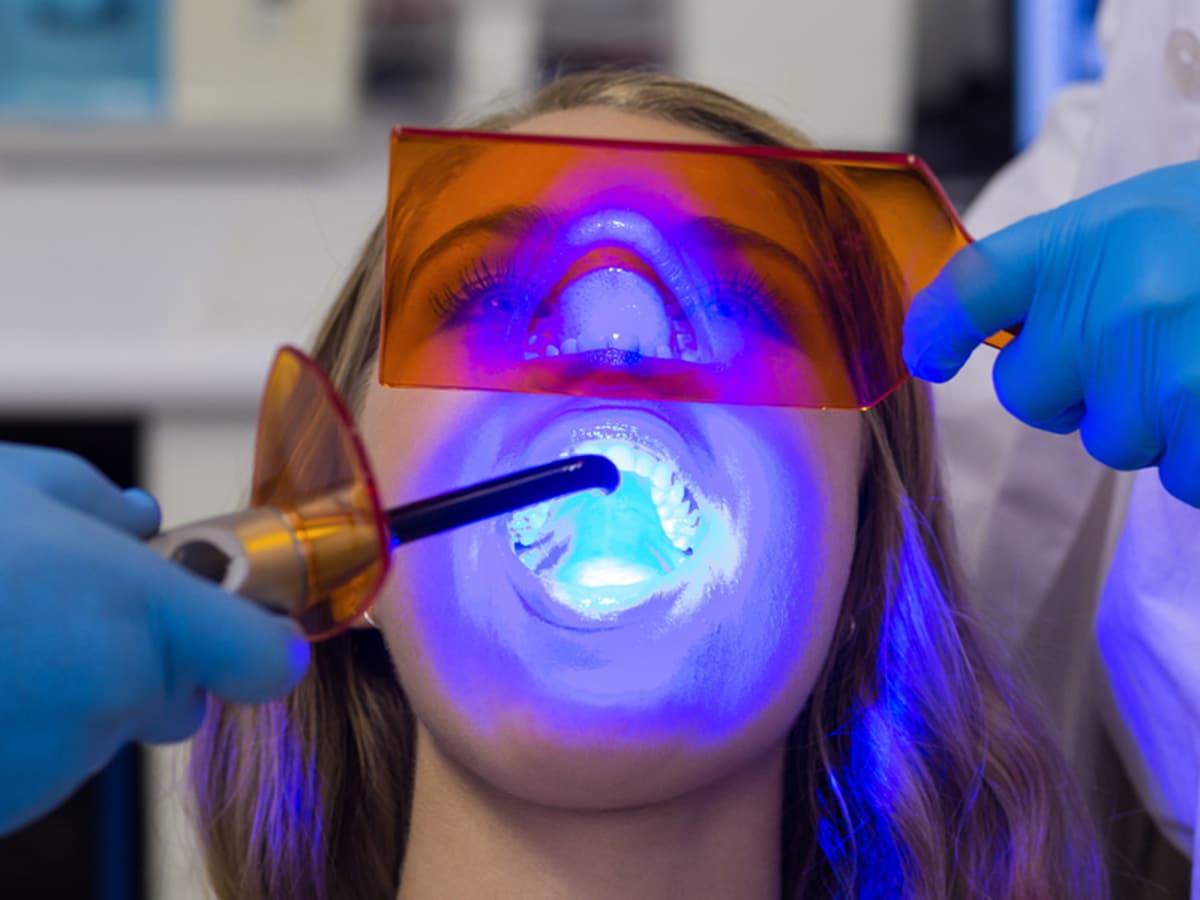 woman on a dentist's chair getting teeth whitening treatment