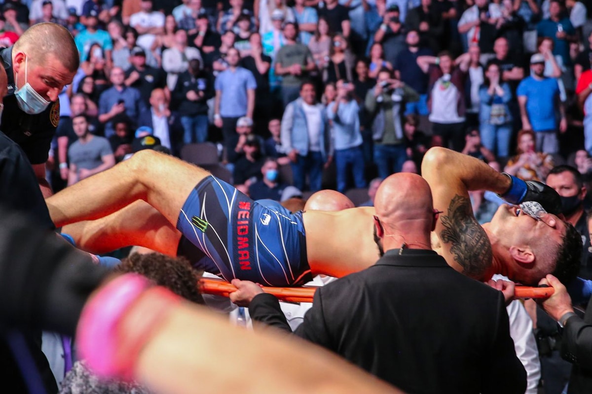 Chris weidman leg injury 2