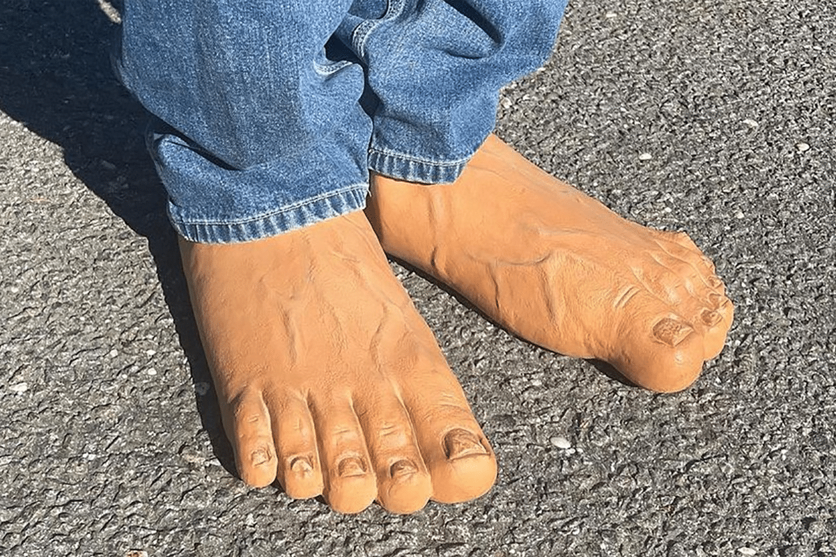 Imran potato human feet slides