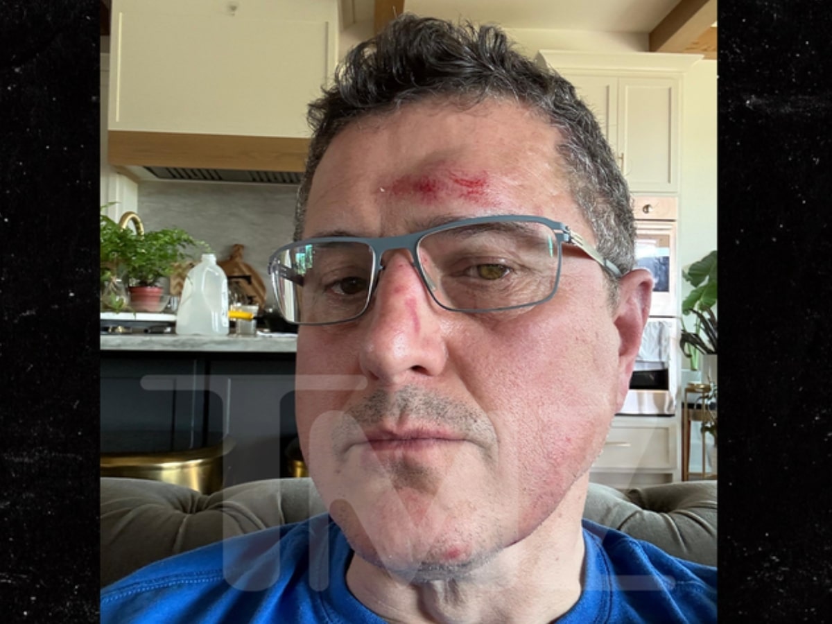 A visibly scarred Ronnie Taylor speaks to TMZ following his altercation with Alan Ritchson.